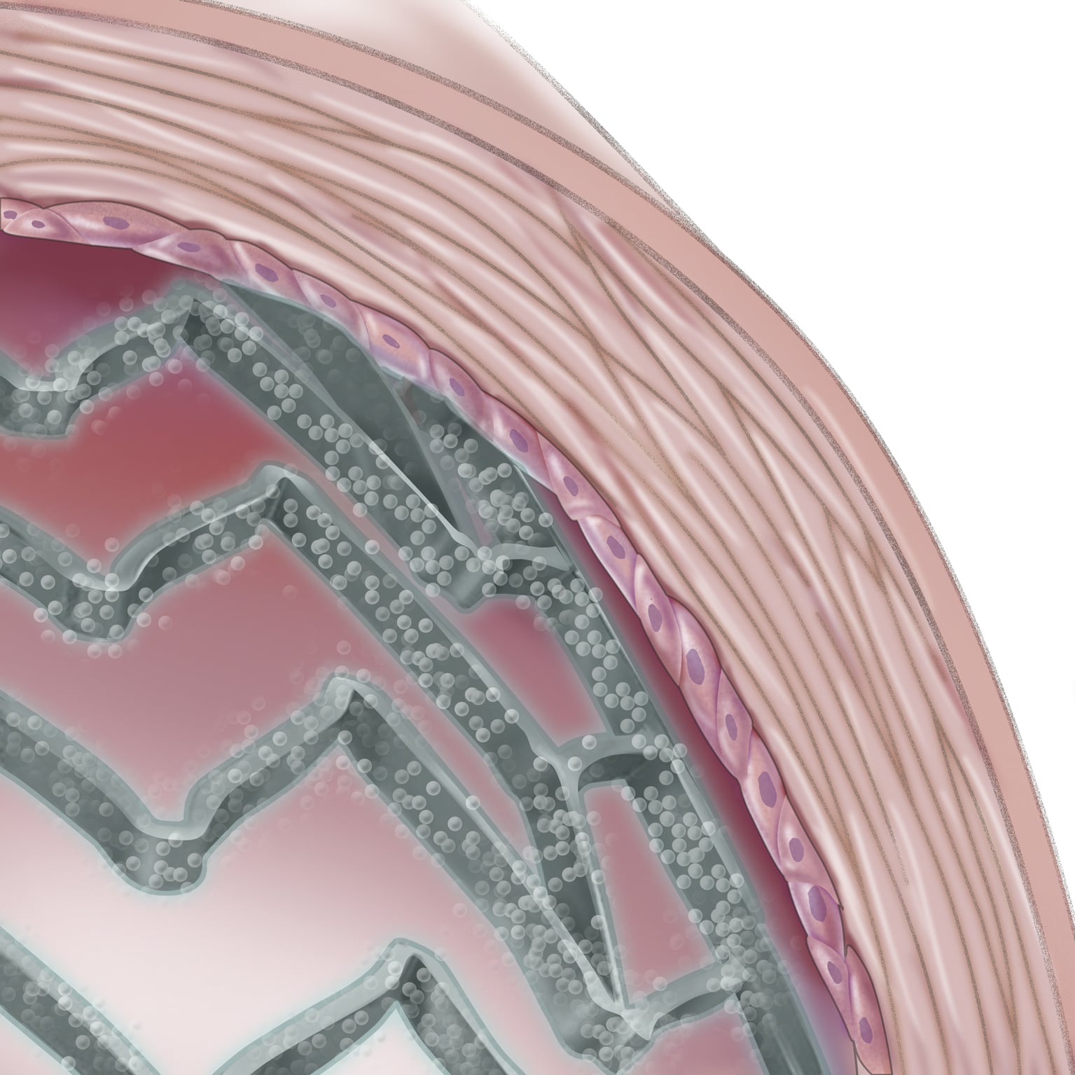 Research Finds Drug-Eluting Stents Used Less Often in Women Than